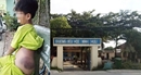 Đình chỉ công tác 15 ngày đối với giáo viên đánh học sinh lớp 1 bầm tím người Đình chỉ công tác 15 ngày đối với giáo viên đánh học sinh lớp 1 bầm tím người