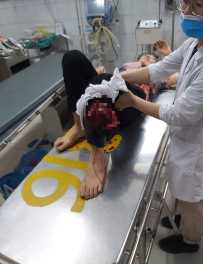 CSGT đưa người phụ nữ gặp tai nạn gẫy chân đi cấp cứu1 - Ảnh minh hoạ 2