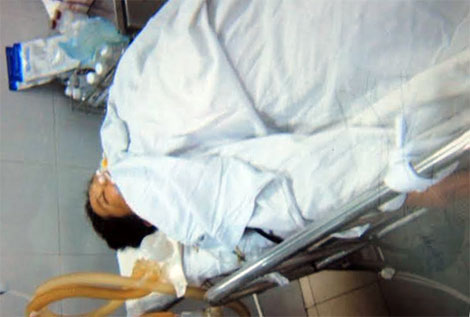 Gãy chân vào viện phẫu thuật thì… tử vong