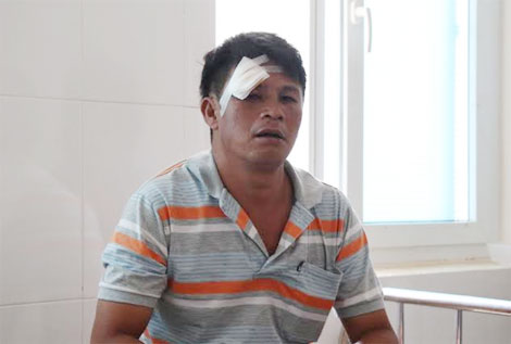 Bắt lâm tặc, một cán bộ bảo vệ rừng bị đánh trọng thương