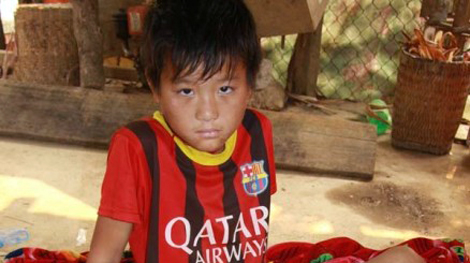 Cậu bé mồ côi được phẫu thuật chân miễn phí