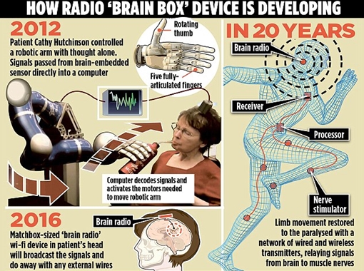 Bệnh nhân liệt toàn thân sẽ hoạt động trở lại nhờ công nghệ y học không dây