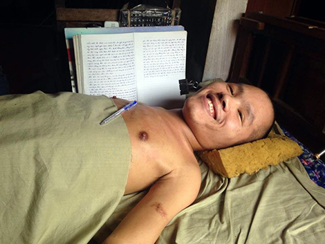 Số phận nghiệt ngã của chàng trai xin được hiến… đầu