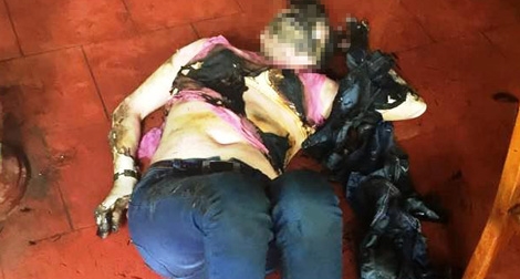 Một phụ nữ bị tưới xăng đốt ngay tại quán cà phê