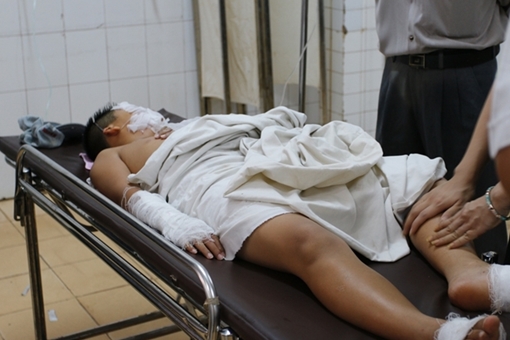 Nổ bình gas khi thực hành môn nấu ăn, nhiều học sinh tiểu học bị bỏng 