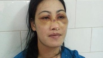 Bạo lực gia đình: Khi người chồng biến thành “hung thần”