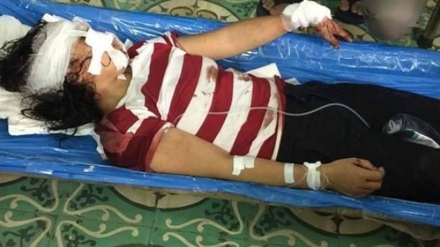 Ráo riết truy bắt đối tượng cắt gân vợ