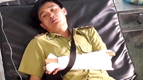 Một cán bộ kiểm lâm bị đánh gãy tay