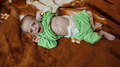 Yemen: Khủng hoảng nhân đạo ngày càng tồi tệ