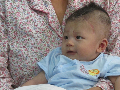 ‘Bé trai bị dao đâm’ nhập viện do viêm màng não 