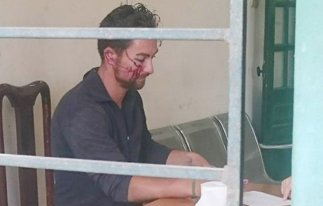 “Phố Tây” và những khoảng tối… 