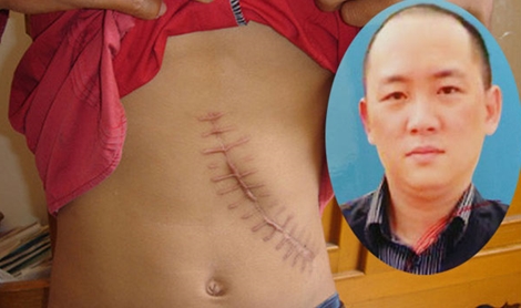 Làm giấy tờ giả, môi giới mua bán thận trái phép