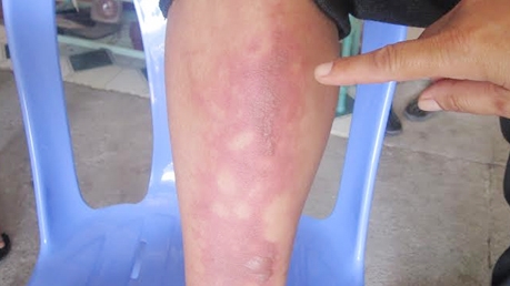 Giang hồ ném chai xăng tự chế, truy sát 1 gia đình