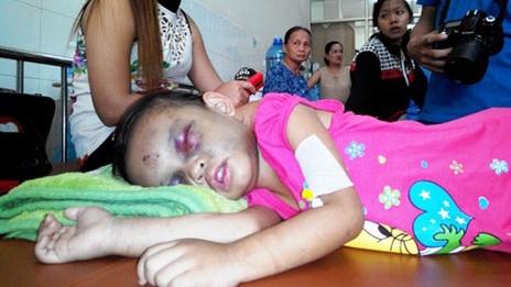 Báo động tình trạng bạo hành trẻ em