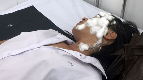 Tạt axit chỉ vì… quá "yêu" ?!