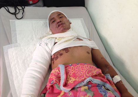 Xử lý nghiêm những kẻ dùng xăng tấn công người khác