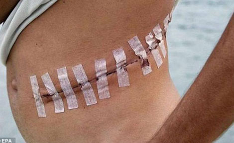 Báo động vấn nạn buôn bán nội tạng người