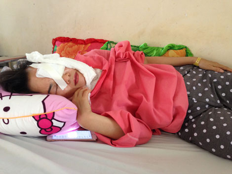 Kẻ bất lương thuê người xịt axít vợ cũ với giá 20 triệu đồng