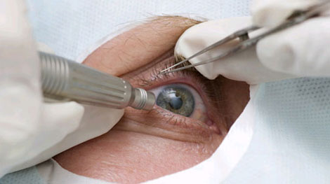 Bệnh viện Mắt Thái Thành Nam phải bồi thường cho bệnh nhân gần 1 tỷ đồng