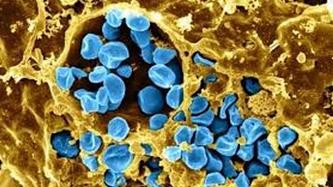 Cơ thể người có thành phần tự chống lại bệnh thỏ?