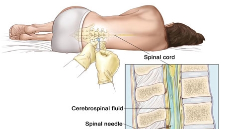 Nguy cơ virus HIV xâm nhập trung tâm não bộ