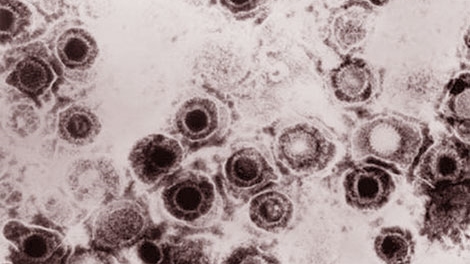 Virus biến đổi gene chống ung thư