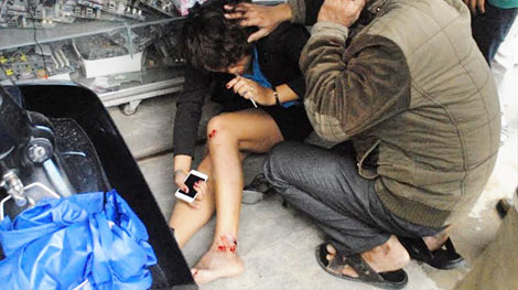 Đà Lạt: Cô gái đuổi theo hai tên cướp bị tai nạn