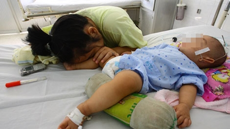 Viêm não do virus – Xin chớ xem thường!