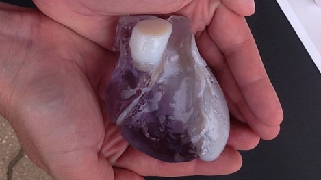 Nghiên cứu các mẫu in 3D cơ quan nội tạng trước khi phẫu thuật