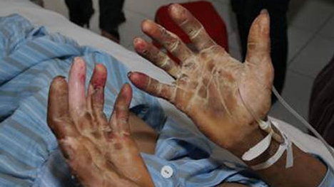 Tiết canh, món ăn nguy hiểm chết người