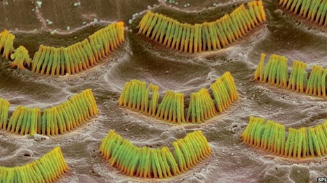 Liệu pháp virus cho người khiếm thính