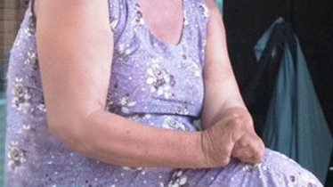 (SỐC): Mổ sỏi thận nhưng bị... cắt cụt tứ chi