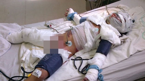 Tự thiêu – Lửa hận thù mang danh tội ác!