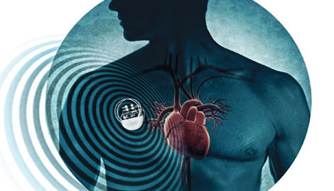 Cảnh báo máy kích thích tim trước nguy cơ tin tặc tấn công