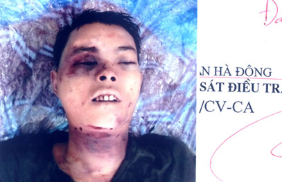 Công an quận Hà Đông tìm tung tích nam thanh niên tử vong bên đường