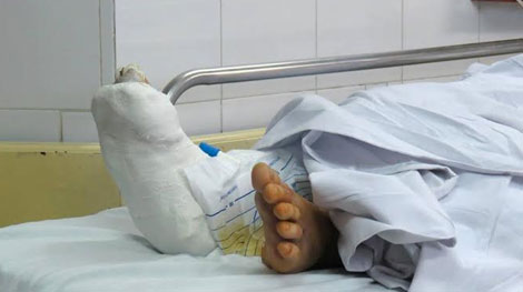 Nạn nhân vào Bệnh viện Việt Đức đã được phẫu thuật kịp thời