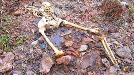 Xác định nguyên nhân chết của "bộ xương" gần bãi tha ma