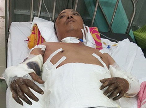 Tận cùng nỗi đau của gia đình người đàn ông bị bỏng xăng