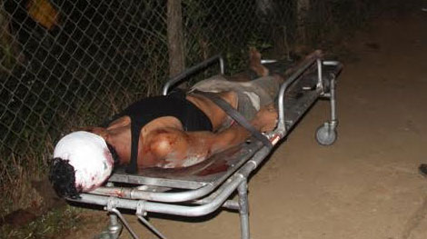 4 người chết ngạt dưới hầm vàng