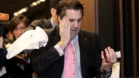 Đại sứ Mỹ tại Hàn Quốc bị rạch mặt giữa chốn đông người