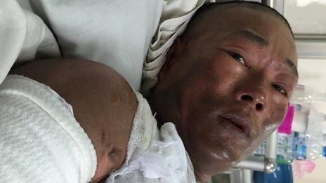 Ném xăng đốt bạn thân vì bị khất nợ quá lâu