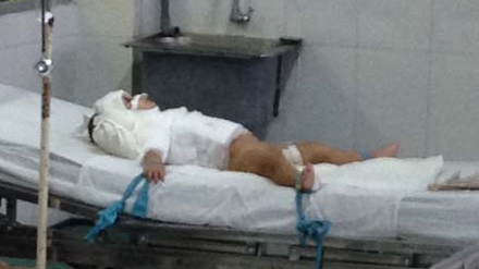 Đau lòng vụ bé gái 2 tuổi bị tạt hóa chất