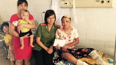 Báo CAND và bạn đọc trao 10 triệu đồng cho 3 mẹ con bỏng nặng trong vụ cháy chợ Phùng Khoang