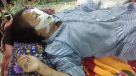 Cuộc sống địa ngục của người phụ nữ bị chồng cắt gân vì đòi ly hôn