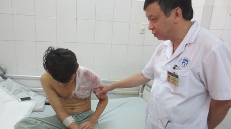 Rùng mình với những đòn thù từ axit