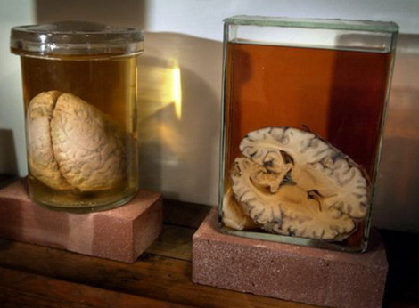 Trộm cắp não và nội tạng người để rao bán trên mạng