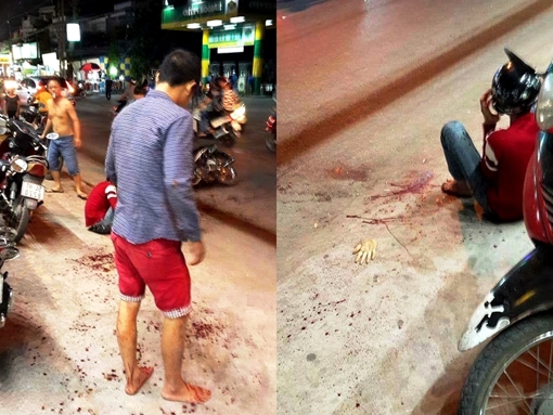 Khởi tố vụ chém người lìa bàn tay trên phố 