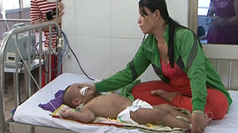 Bé 2 tuổi bị bà ngoại đánh nhập viện đã qua cơn nguy kịch