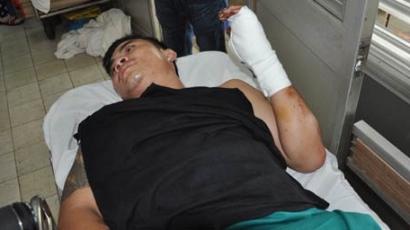 Mối họa từ thói hung hăng, côn đồ