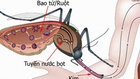 Bệnh sốt rét tăng cao